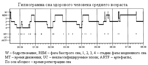 Гипнограмма сна